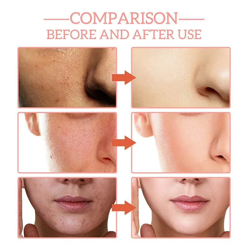 Gluta White Face Glowing Serum – 30ml | Glutathione-Based Brightening | Hydration + Antioxidants