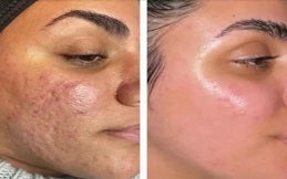 Gluta White Glow Serum – Brightening & Hydration (30ml)