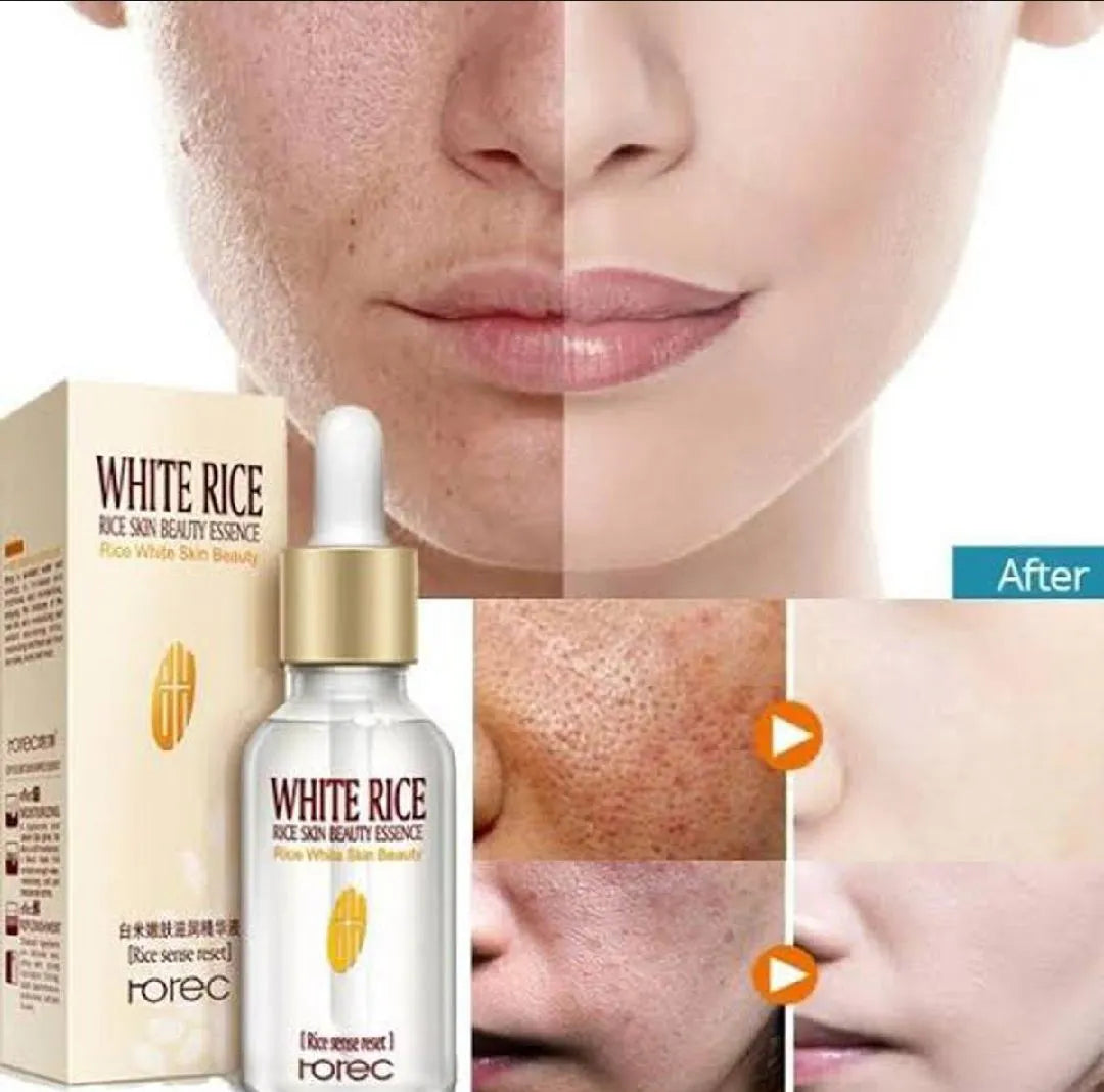 White Rice Face Serum – Moisturizer, Anti-Wrinkle, Anti-Aging, Acne Treatment (15ml)