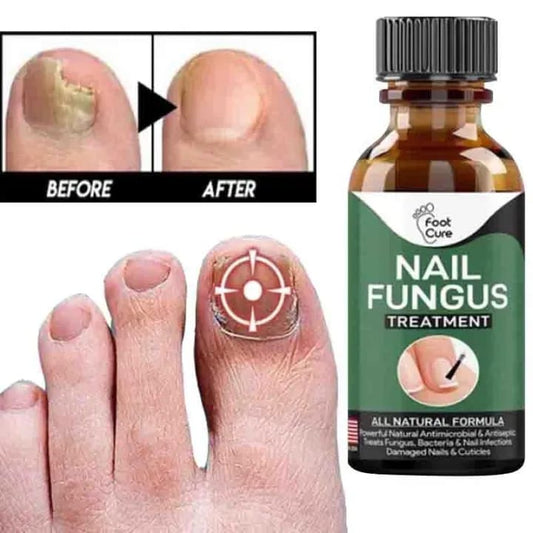 Fast Nail Fungus Treatment Serum – Nail Repair Essence for Finger & Toenail Care (All-Natural Formula)